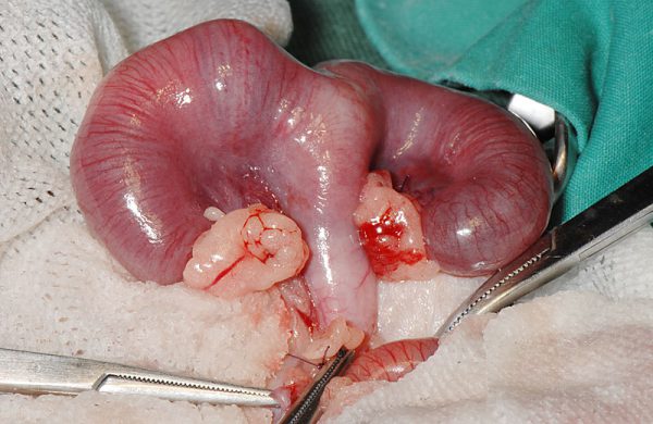 ハリネズミの子宮の腫瘍