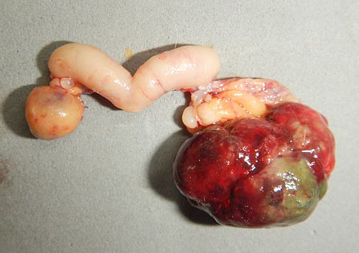 ハリネズミの卵巣の腫瘍