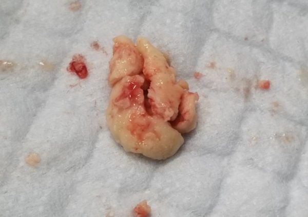 ヒョウモントカゲモドキの膿瘍