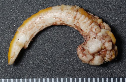 プレーリードック歯牙腫